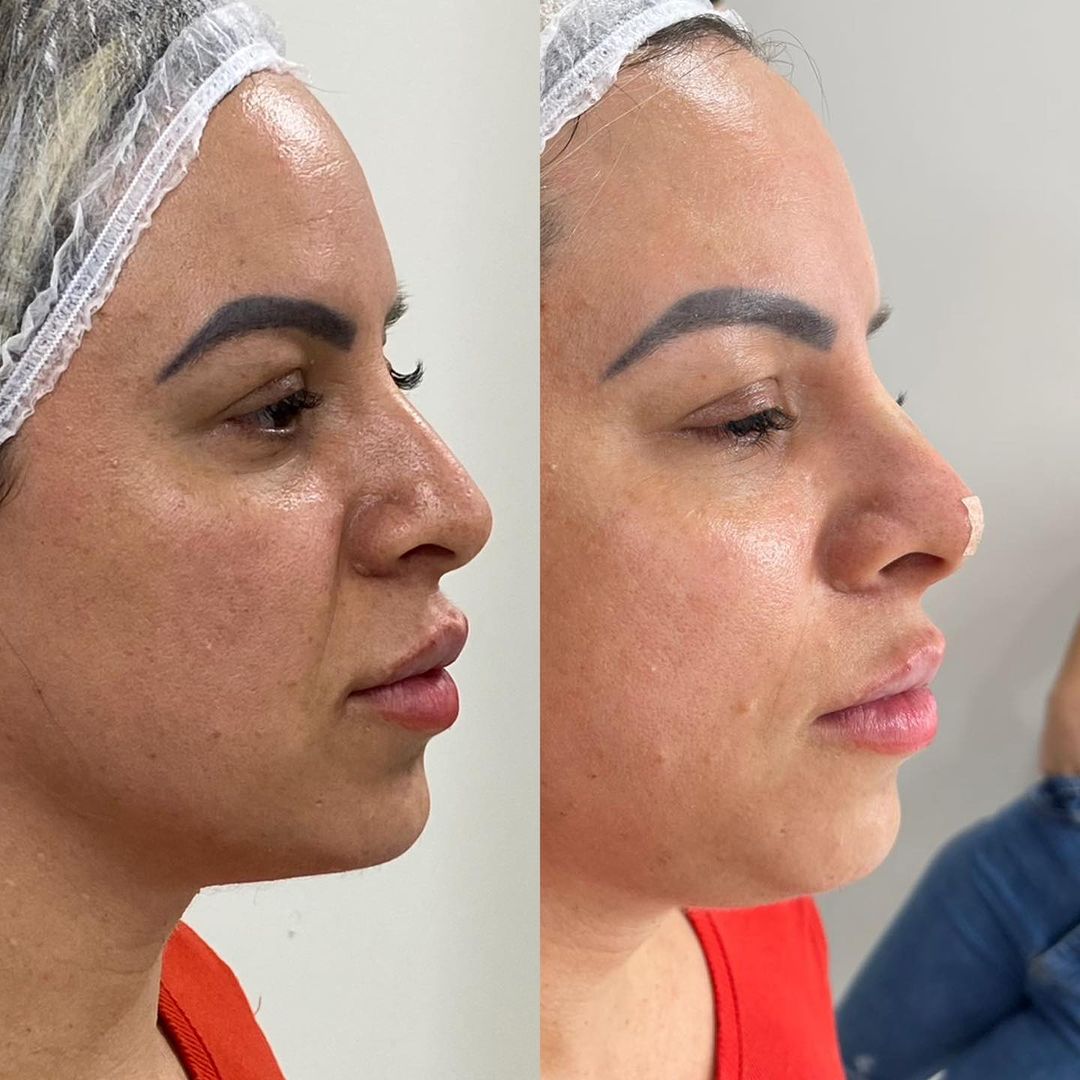 Snapinsta.app_391734186_709863807946660_1541819055306250523_n_1080 (1)